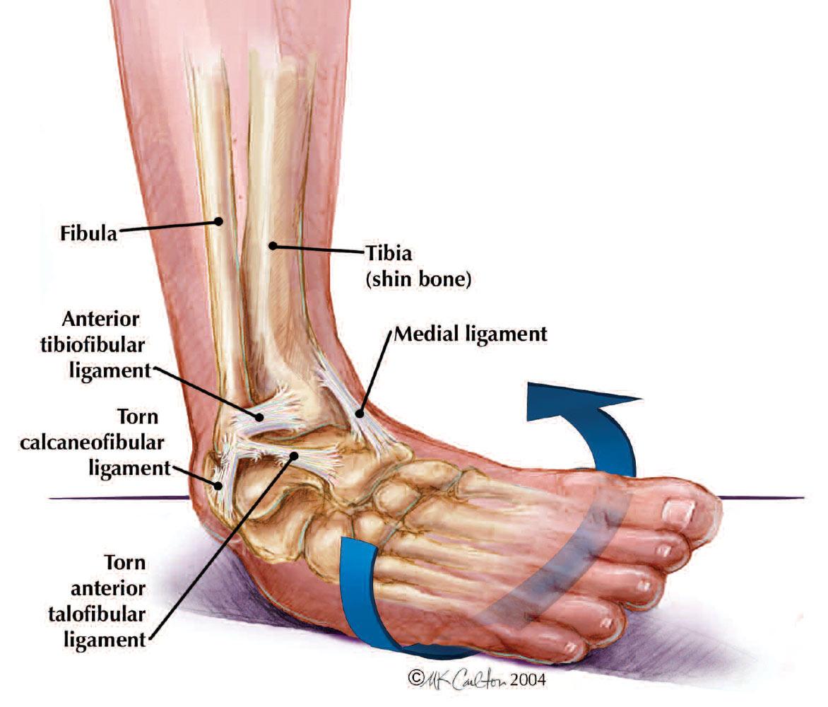 Ankle Proprio Rehab  Osteopathy and Physiotherapy in Northampton